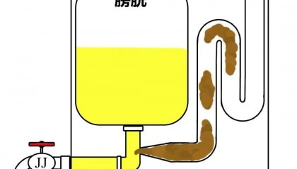 男童用小鸡鸡拉屎5年！医生震惊：拖这么晚才就医！有患儿家长一语道破辛酸