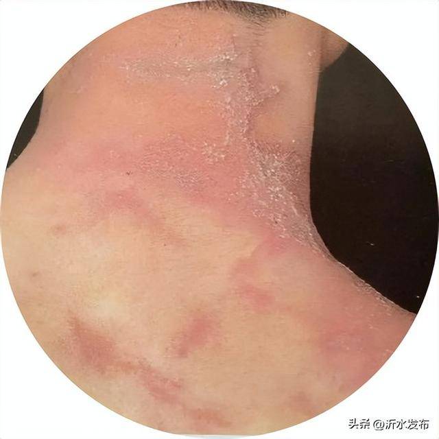 山东多地现这种虫子，千万别拍！